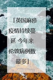英国麻疹疫情持续蔓延 今年来伦敦病例数最多