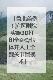 鲁北首例！滨医附院实施3D打印全距骨假体并人工全踝关节置换术